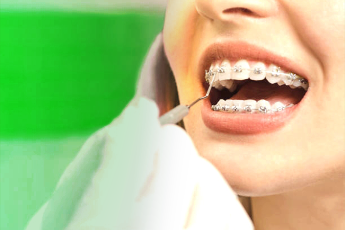 Orthodontics