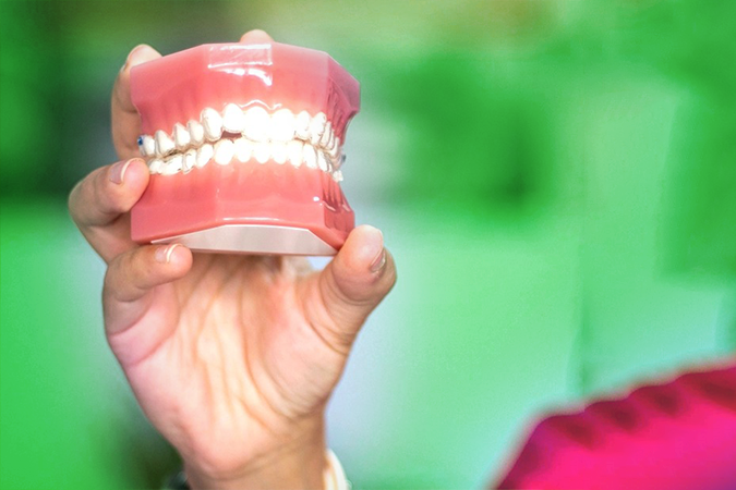 Dentures