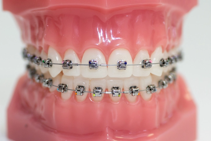 Orthodontics